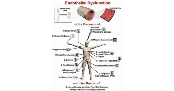 Dysfunction Meaning and Definition