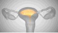 What to Do for Egg Growth in Women? Methods to Improve Egg Quality...