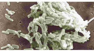 At Least 2 Dead in Listeria Outbreak Tied to Deli-Sliced Meat 