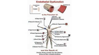 Dysfunction Meaning and Definition